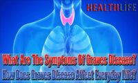 What Are The Symptoms Of Graves Disease