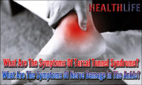 What Are The Symptoms Of Tarsal Tunnel Syndrome