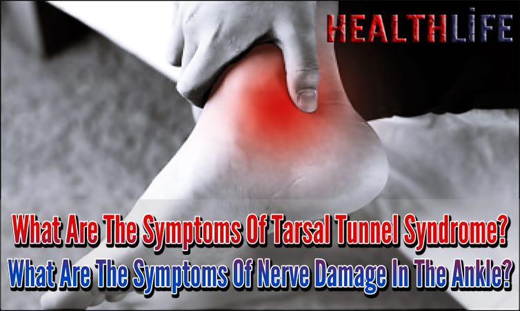 What Are The Symptoms Of Tarsal Tunnel Syndrome