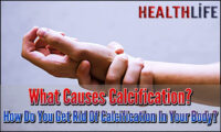 What Causes Calcification