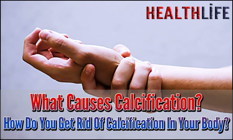 What Causes Calcification