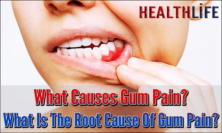 What Causes Gum Pain