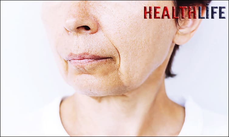 At What Age Do Cheeks Start Sagging