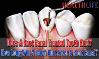 Does A Root Canal Treated Tooth Hurt