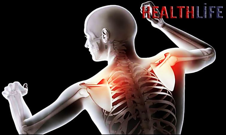 How Do I Know If I Have Nerve Compression