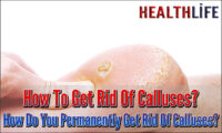 How To Get Rid Of Calluses