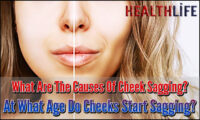 What Are The Causes Of Cheek Sagging