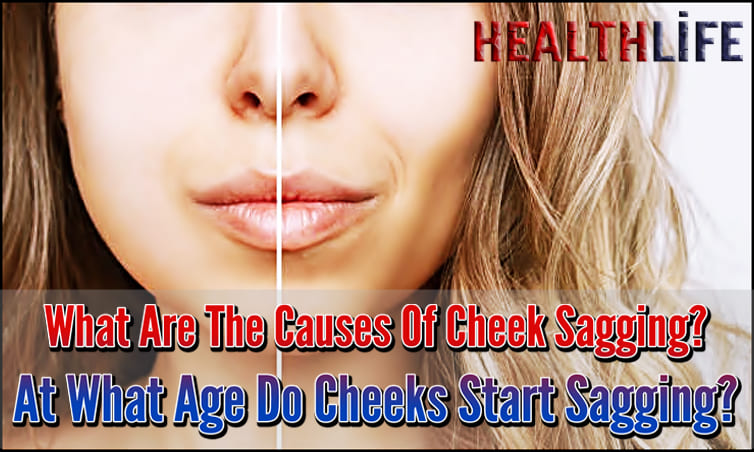 What Are The Causes Of Cheek Sagging