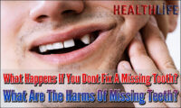 What Are The Harms Of Missing Teeth