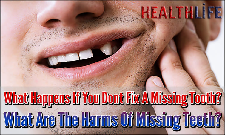 What Are The Harms Of Missing Teeth