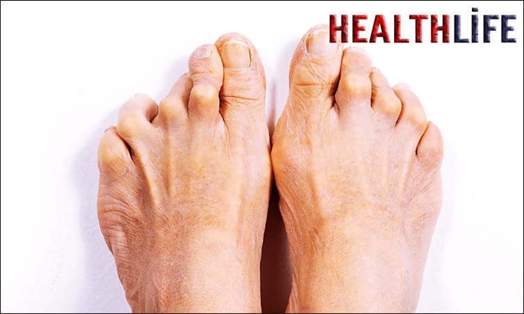 What Are The Main Causes Of Rheumatism