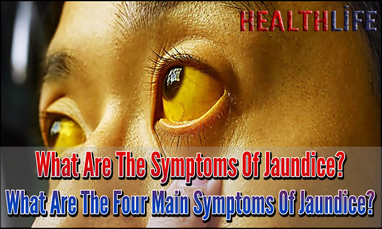 What Are The Symptoms Of Jaundice
