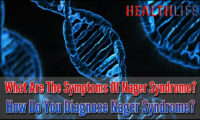 What Are The Symptoms Of Nager Syndrome