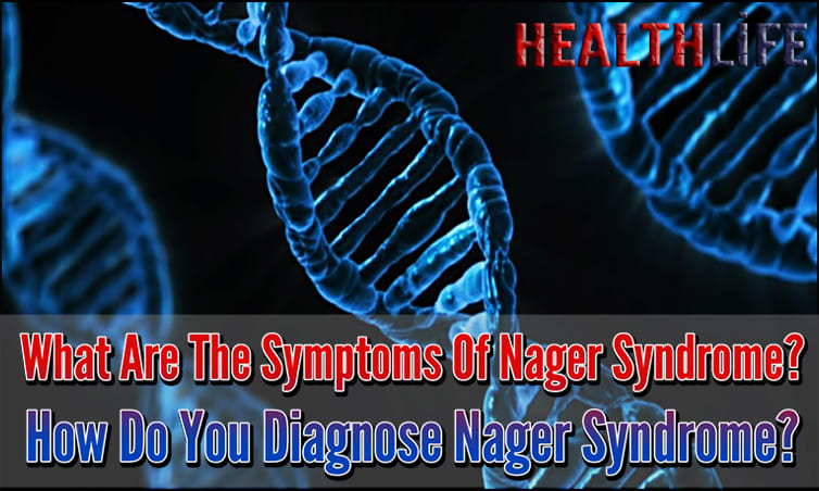 What Are The Symptoms Of Nager Syndrome