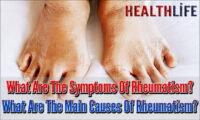 What Are The Symptoms Of Rheumatism