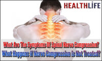 What Are The Symptoms Of Spinal Nerve Compression