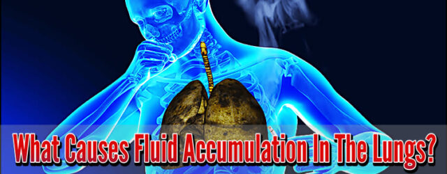 What Causes Fluid Accumulation In The Lungs