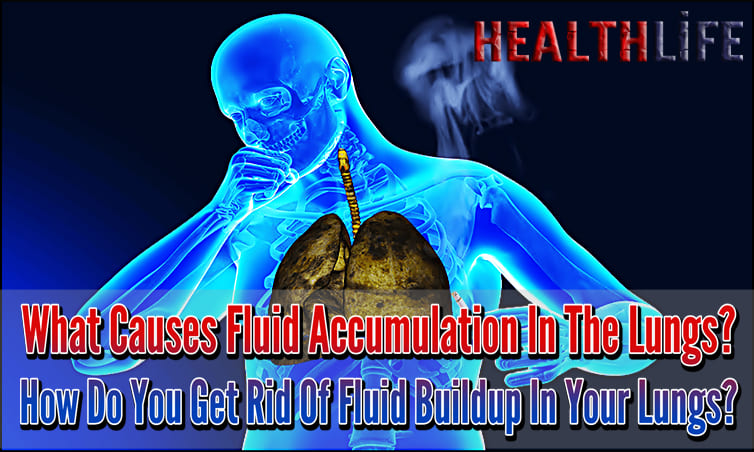 What Causes Fluid Accumulation In The Lungs