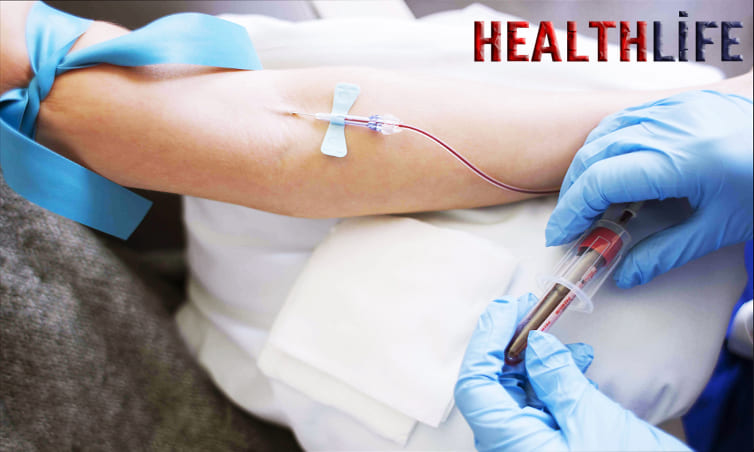 Why Would A Doctor Order A Blood Gas Test