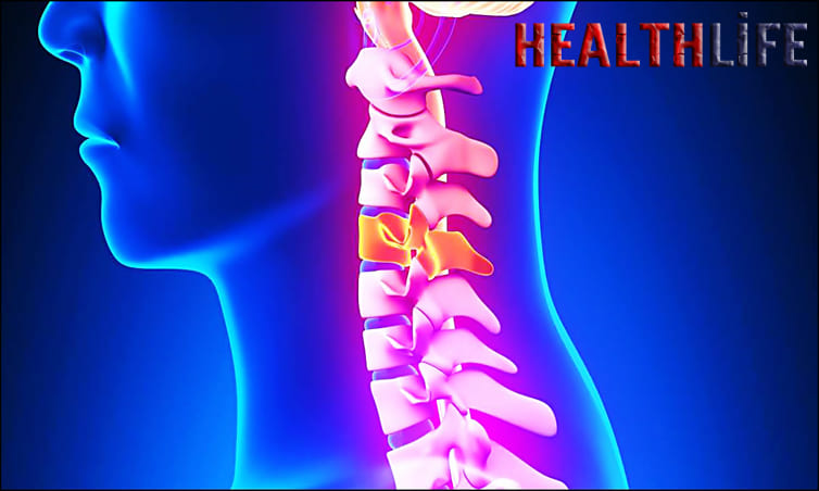 How To Fix Straight Neck Posture