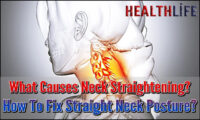What Causes Neck Straightening