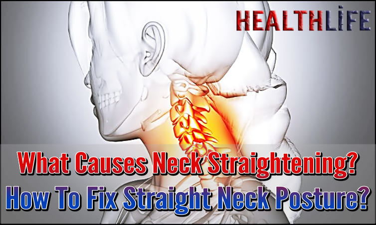 What Causes Neck Straightening